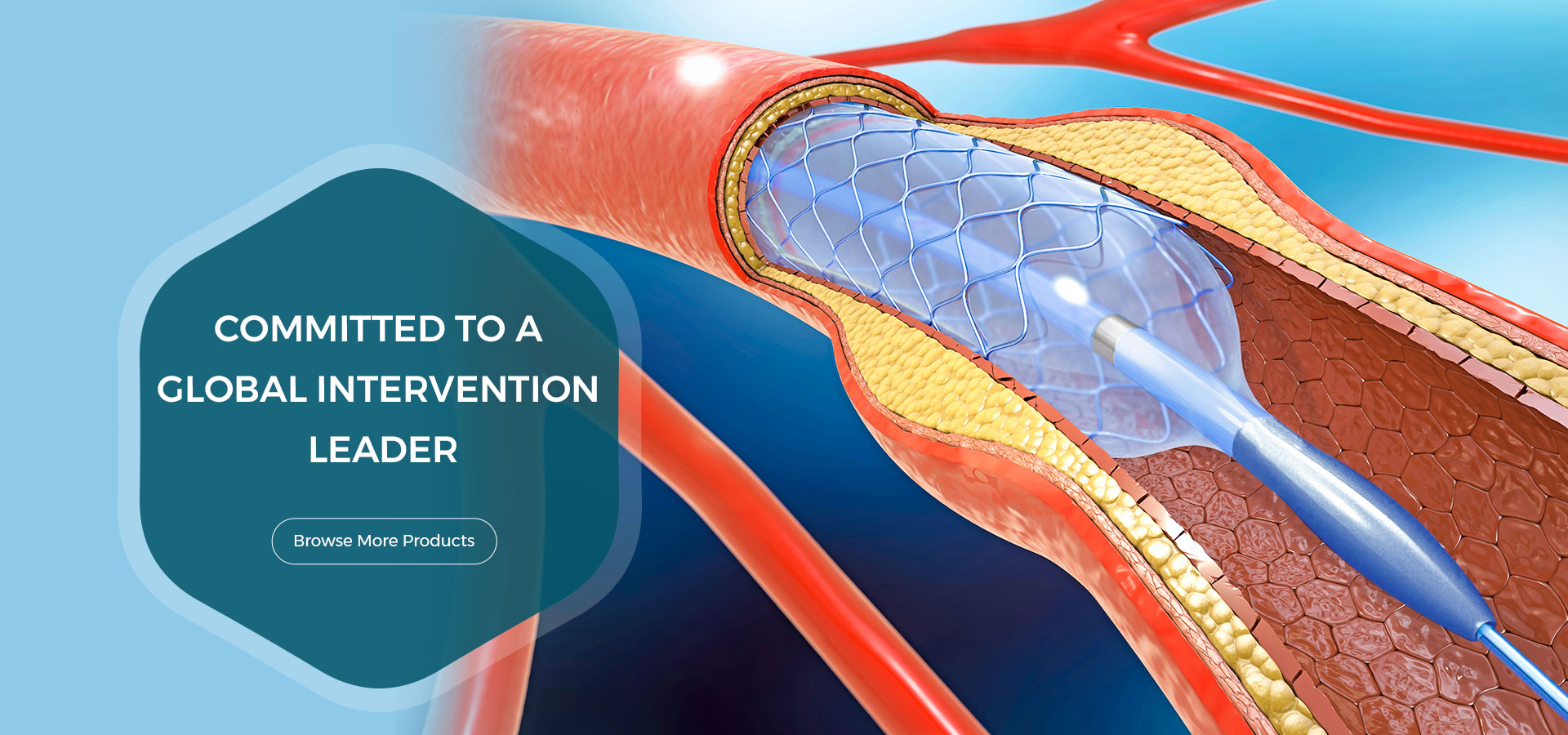 PTCA Balloon catheter、Drug-eluting stent